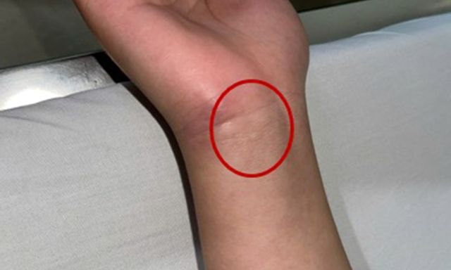 Bệnh viện Trung ương Quân đội 108 phát cảnh báo về 1 căn bệnh nguy hiểm, nhà nào cũng có nguy cơ mầm mống trú ngụ