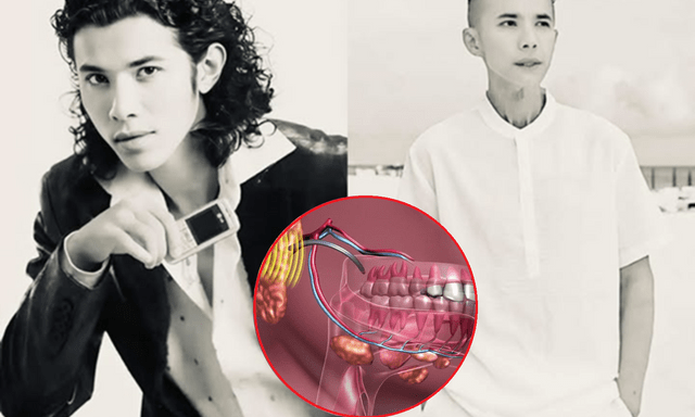 Kasim Hoàng Vũ qua đời vì 1 căn bệnh dễ bị bỏ qua: Triệu chứng ban đầu mờ nhạt, những ai cần đặc biệt cảnh giác?