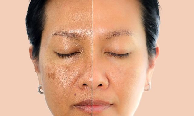 Oxy cao áp: Khi nào dùng để làm đẹp, chống lão hóa và kiểm soát bệnh chuyển hóa?