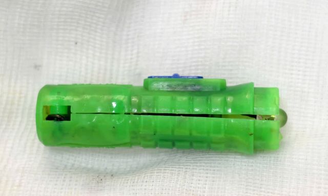 Bé 11 tuổi viêm âm đạo suốt 5 tháng, đến gặp bác sĩ Bệnh viện Phụ sản Hà Nội thì gắp được 1 vật hoen gỉ bên trong