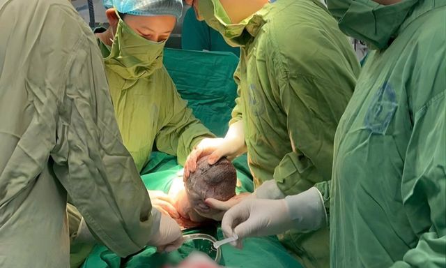 Em bé sinh ra với 