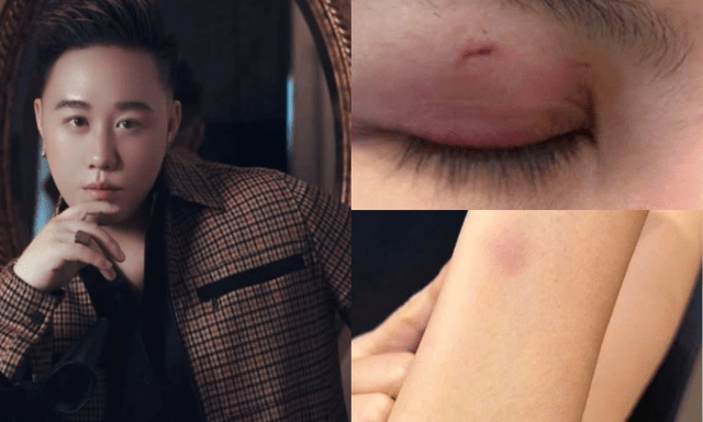 Ca sĩ Trung Quân Idol bị tố hành hung phụ nữ: Luật sư nói gì về trách nhiệm pháp lý?