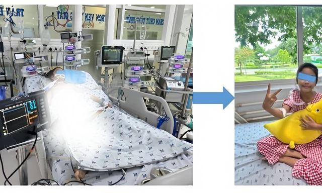 Bé gái 11 tuổi phải thở máy, lọc máu sau 3 ngày sốt: BS Bệnh viện Nhi Đồng Thành Phố cảnh báo sai lầm của nhiều gia đình