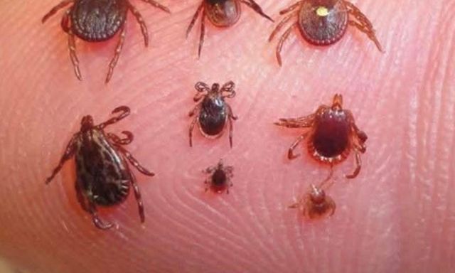 Gắp ra 17 con ve trên cơ thể người đàn ông bị sốt cao kéo dài