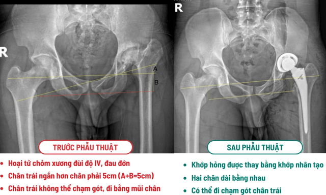 Khách Tây là kỹ sư vượt 10.000km sang 1 bệnh viện ở Việt Nam phẫu thuật: 