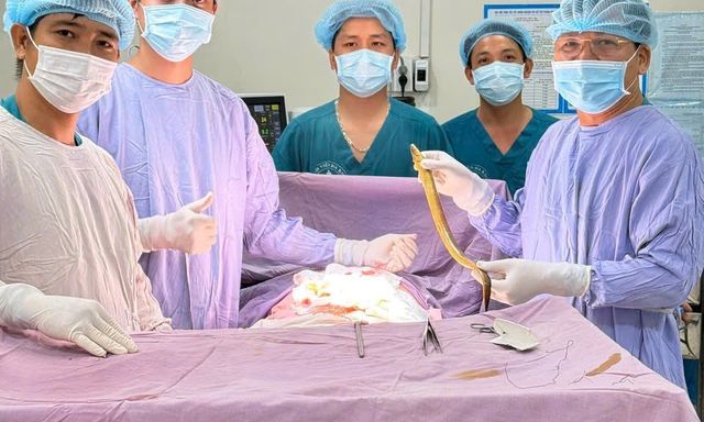 Lươn dài 50cm chọc thủng trực tràng, nằm ngoe nguẩy trong ổ bụng bệnh nhân