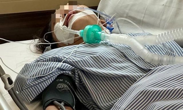 Trung Quốc: Cô gái 24 tuổi sốc phản vệ, rơi vào nguy kịch vì uống 10ml nước dừa giải nhiệt
