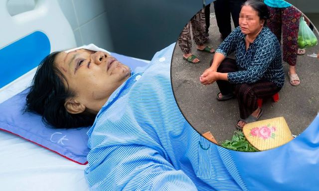 Gặp người phụ nữ bán rau bị xịt nước chảy máu mắt ở Phú Thọ: 