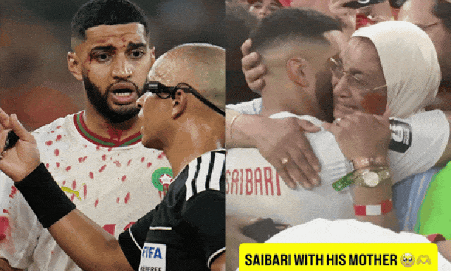 Sao World Cup rách mí mắt, chảy bê bết máu vẫn thi đấu cực 