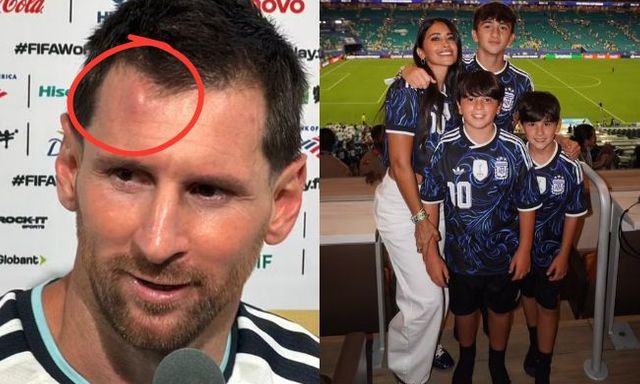 Messi sưng u đầu, được vợ đẹp con ngoan động viên sau chiến thắng nhọc nhằn của Argentina trước Cape Verde