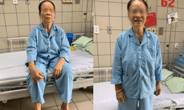 Cụ bà 90 tuổi bị ung thư dạ dày: Sau đại phẫu 1 ngày tự ngồi dậy, chưa đến 1 tuần đã xuất viện