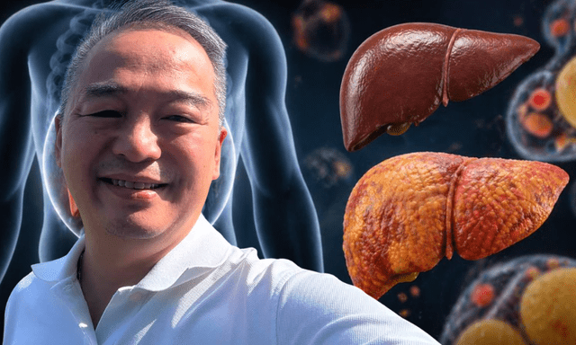 Lời khuyên của Giám đốc Bệnh viện Đại học y Hà Nội đến người bị gan nhiễm mỡ