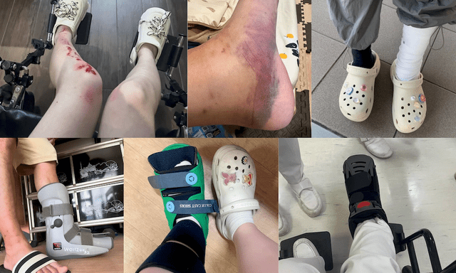 Lời khuyên cho những người thích đi dép sục, dép 
