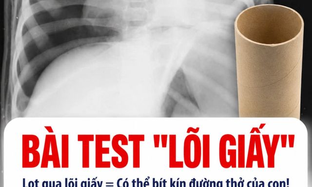 BS chuyên khoa Nhi tiết lộ: Chỉ bằng bài kiểm tra với lõi giấy vệ sinh, cha mẹ có thể ngăn con hóc dị vật