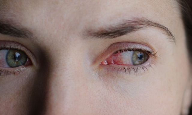 Chàng trai 24 tuổi mù đột ngột: Bác sĩ cảnh báo về thói quen mà nhiều người trẻ đang mắc mỗi tuần