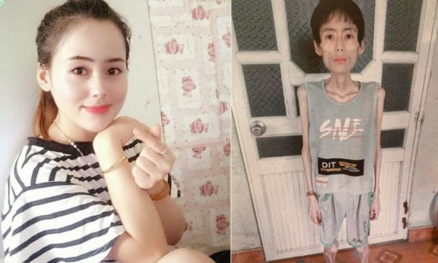 Cô gái Hưng Yên chỉ nặng 19kg vì nhịn cơm giảm cân: Từng 54
kg, xinh gái có tiếng, hé lộ căn bệnh mắc phải