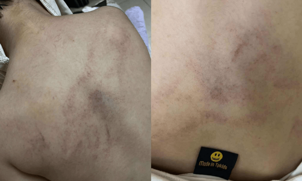 Nóng: Bé gái 4 tuổi bị cô giáo mầm non công lập ở Hà Nội bạo hành dã man, trích xuất camera phát hiện hành động gây sốc