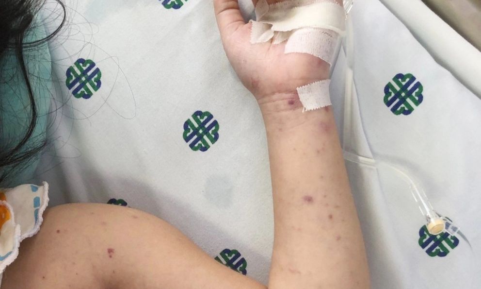 Trung tâm kiểm soát bệnh tật TP. HCM cảnh báo khẩn: Căn bệnh nguy hiểm, có thể tử vong sau vài giờ