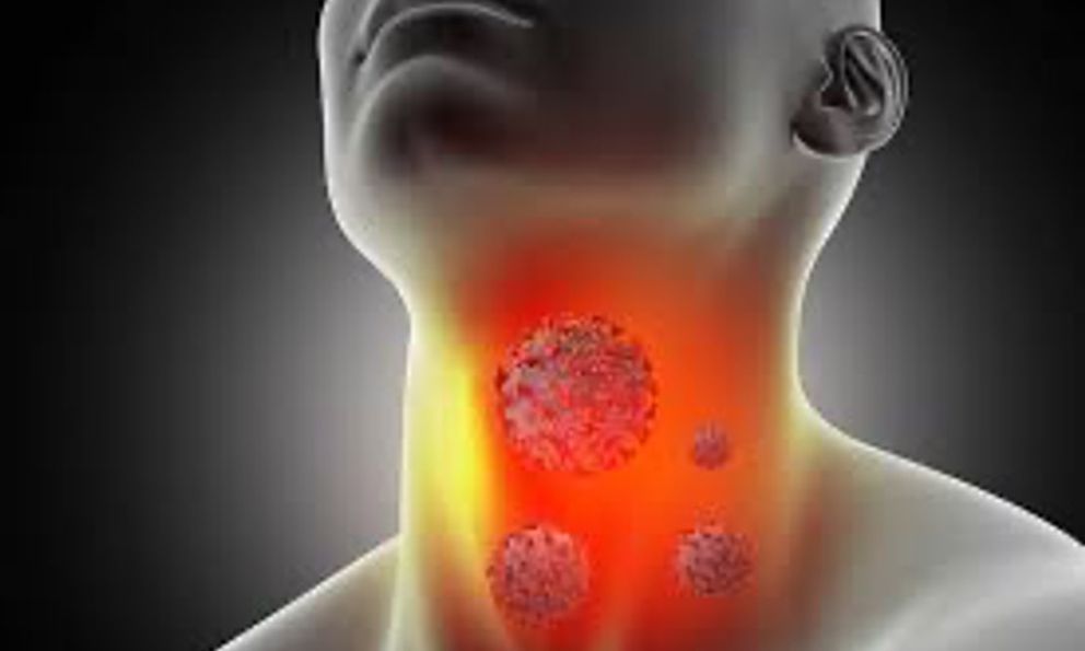 Cổ lên hạch tưởng bị viêm, người đàn ông bất ngờ phát hiện ung thư vòm họng giai đoạn 2: Các dấu hiệu hay bị xem thường