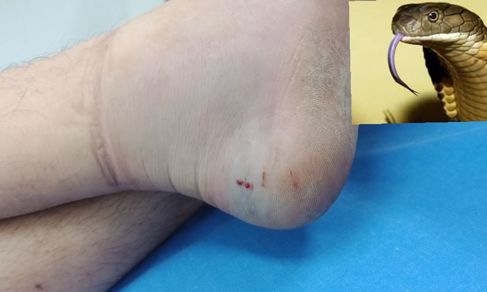 Thí sinh The Voice qua đời vì bị rắn độc cắn trong phòng ngủ