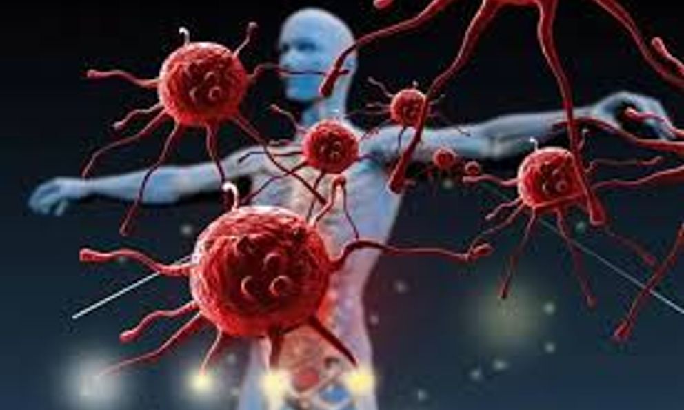 7 thay đổi bất ngờ trên cơ thể: Rất có thể ung thư đã tìm tới bạn!