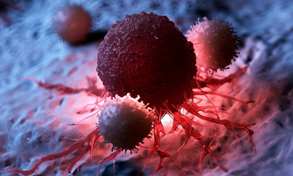 Khi ung thư mới gõ cửa, cơ thể thường có 3 dấu hiệu SỚM