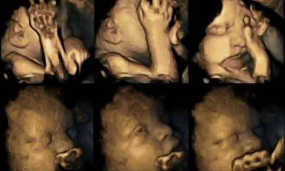 Nghiên cứu Mỹ: Chồng hút thuốc, vợ sảy thai, đứa trẻ chưa ra đời đã phải học cách chịu đựng khói thuốc 