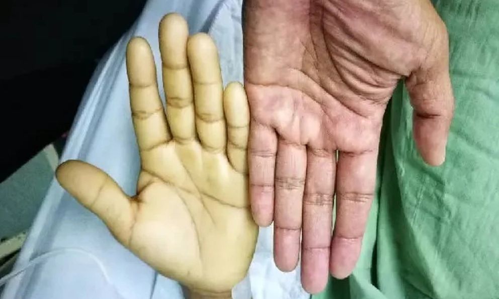 Vì sao ngày nào cũng uống sữa nhưng vẫn thiếu máu?