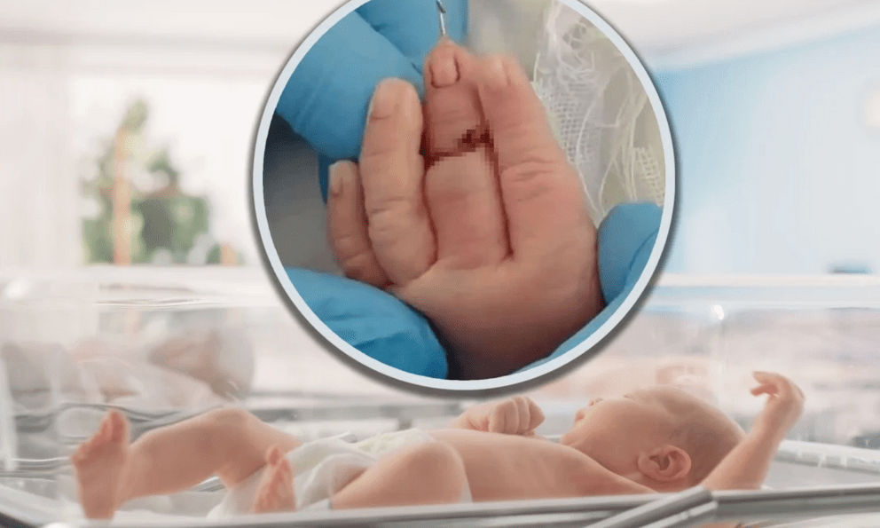Cắt dây rốn, nữ hộ sinh vô tình cắt đứt ngón tay trẻ sơ sinh: Bé phải nối ngón, gia đình bàng hoàng