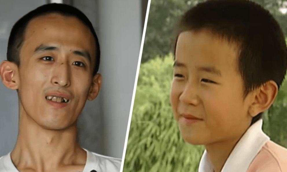 Thần đồng 10 tuổi vào đại học, 16 tuổi lấy bằng Tiến sĩ: Nay thất nghiệp, sống 