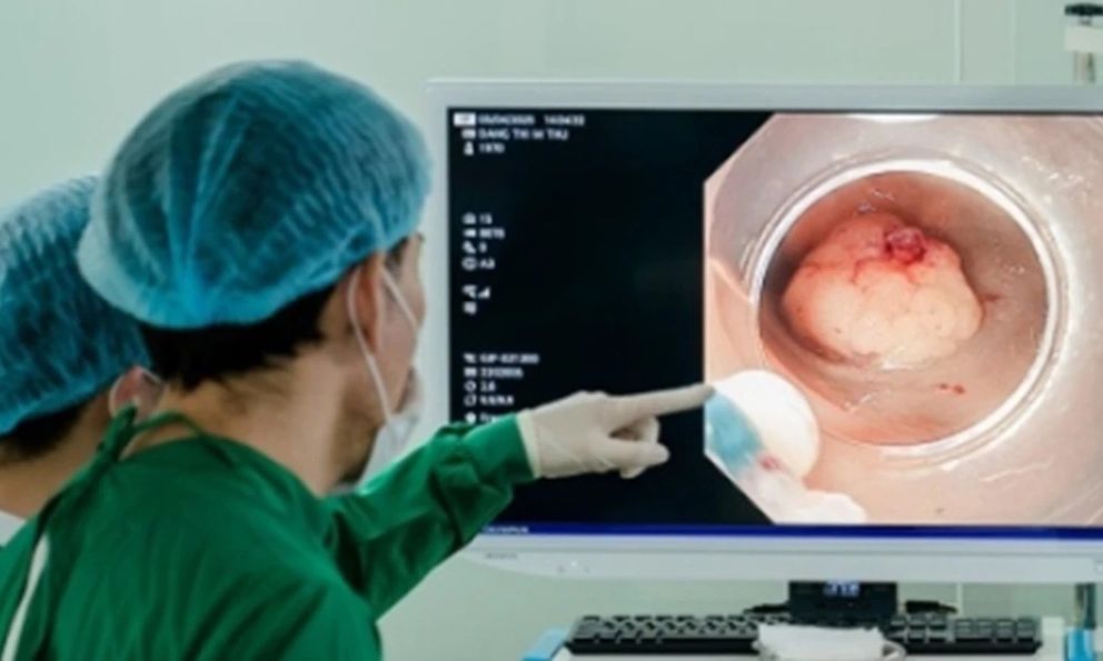 Sụt 5kg trong 1 tháng, người đàn ông 47 tuổi mắc cùng lúc 2 bệnh ung thư: Thủ phạm từ thói quen uống 300ml loại đồ uống này mỗi ngày