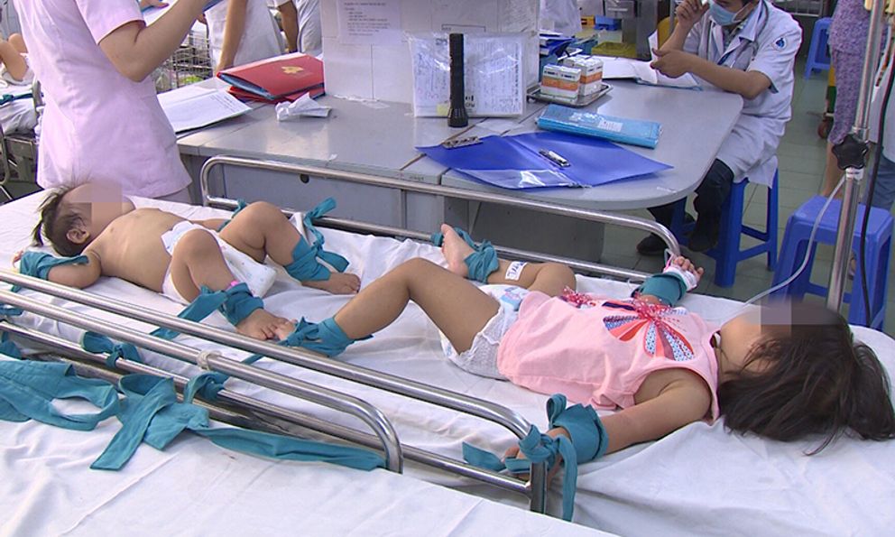 Bệnh tay chân miệng xuất hiện chủng mới nguy hiểm, đã có trẻ đã tử vong: Cha mẹ cần BIẾT NGAY những dấu hiệu này!