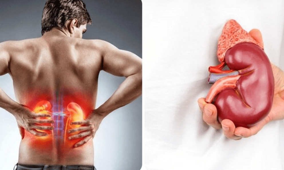 Nghiên cứu trên 417 người chỉ ra 5 ĐIỂM chung của người suy thận: Nhiều thói quen người Việt vẫn vô tình làm mỗi ngày