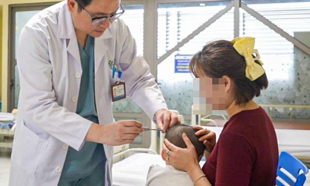 Bệnh viện Nhi Trung ương: Mỗi ngày kéo giãn 1 milimet, từng bước thay đổi khuôn mặt trẻ mắc dị tật sọ mặt