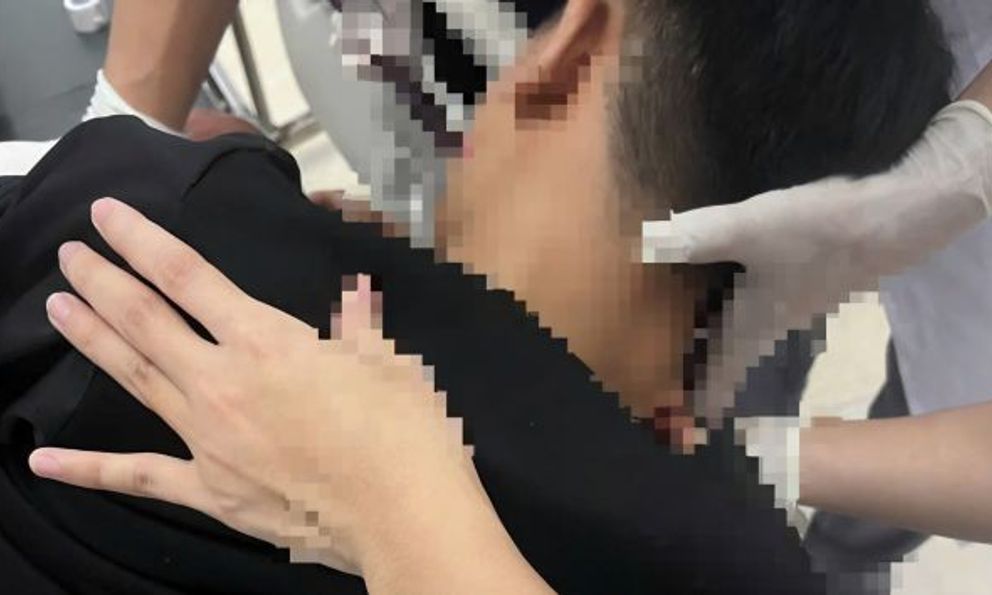 Xô xát khi múa lân, thiếu niên bị ném vật nhọn vào mặt gây trọng thương