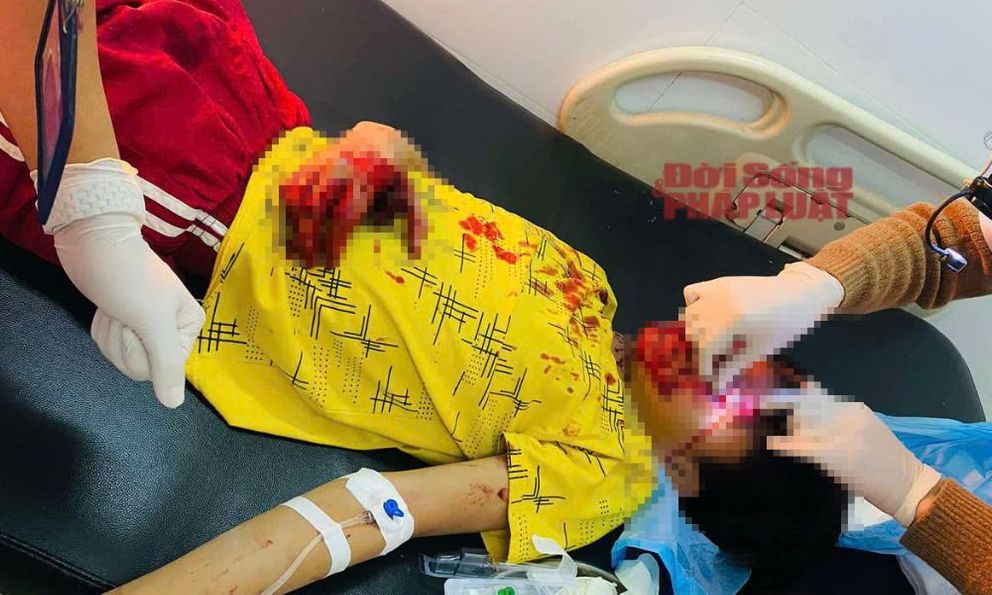 Nghệ An: Nam thiếu niên bị dập bàn tay do điện thoại phát nổ khi sạc