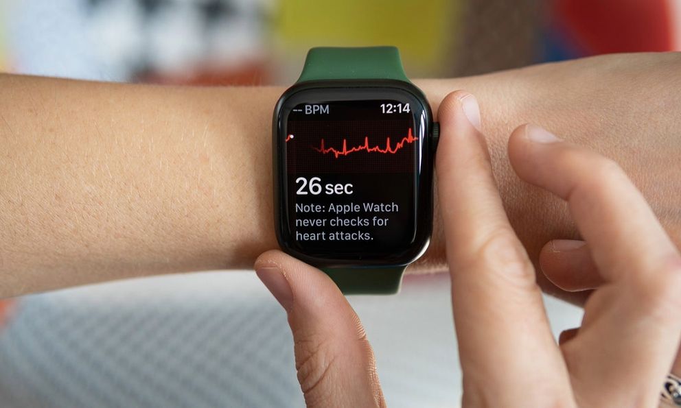 Nghiên cứu: Apple Watch phát hiện sớm nguy cơ đột quỵ tốt hơn cả khám định kỳ