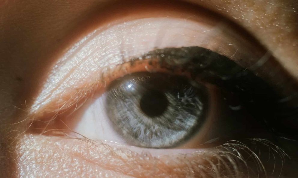 Đến năm 2050, một nửa dân số thế giới sẽ bị cận thị!