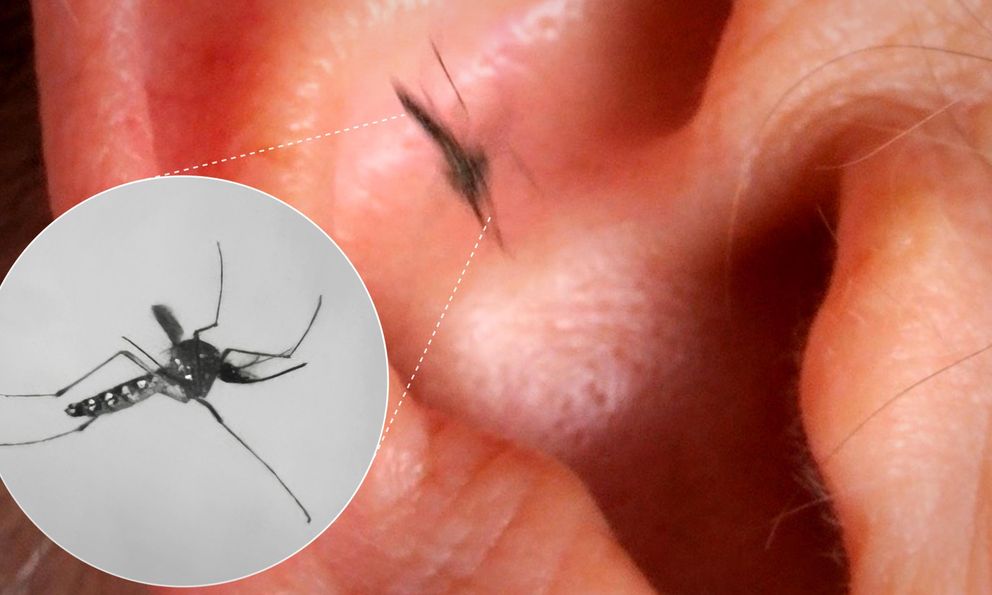 Vì sao muỗi luôn vo ve bên tai con người dù điều đó khiến chúng dễ bị phát hiện và tiêu diệt