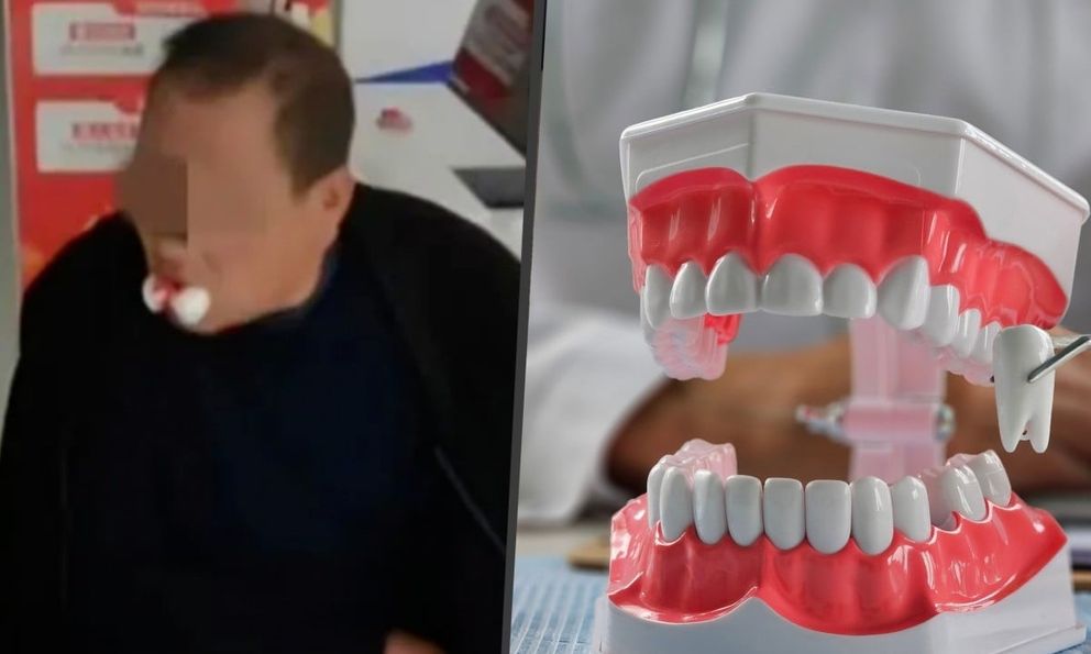 Trung Quốc: Người đàn ông 63 tuổi suýt mất mạng vì tin lời quảng cáo nha khoa, bị nhổ 12 răng trong một lần khám