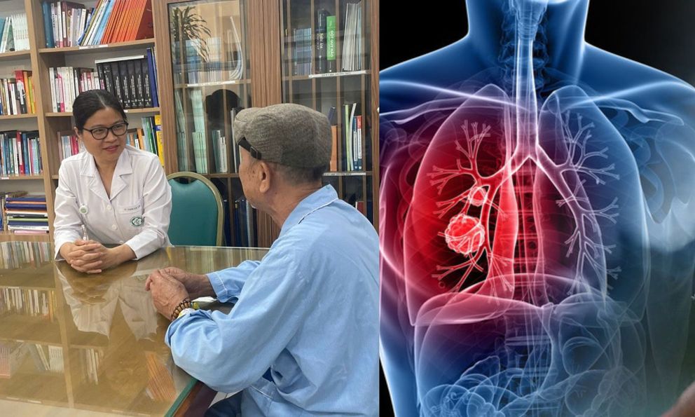 90% ca ung thư phổi của người Việt xuất phát từ thói quen này: Bạn có đang mắc phải?