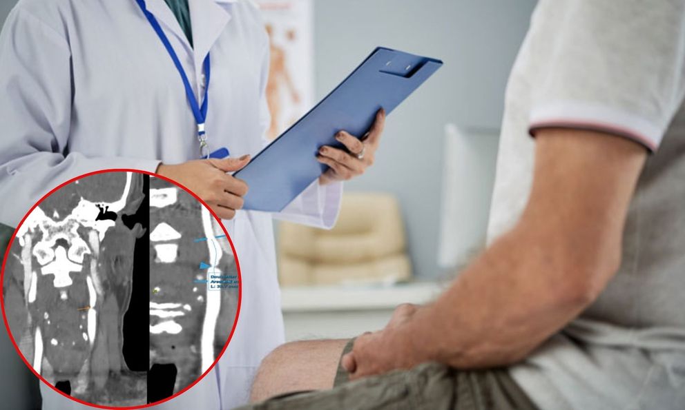 Tình cờ làm điều này, người đàn ông Hà Nội 'thoát' đột quỵ trong gang tấc