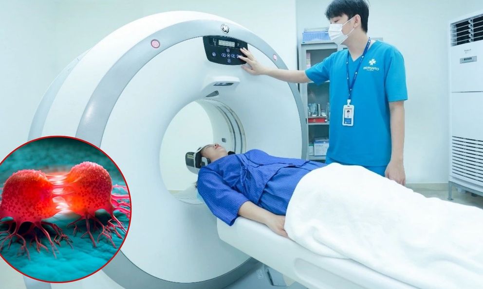 Từ chối chụp CT vì sợ 'gây ung thư': Bác sĩ Việt tại Nhật cảnh báo hậu quả nghiêm trọng