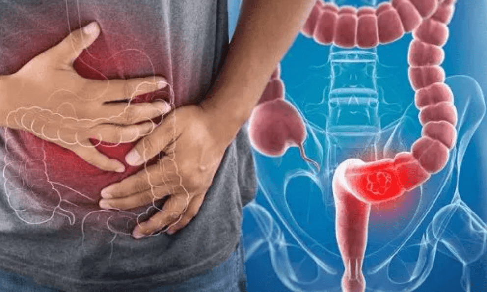 3 thói quen giúp giảm tới 90% nguy cơ mắc ung thư: Đơn giản đến mức ai cũng làm được