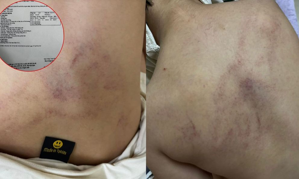 Vụ bé 4 tuổi bị giáo viên đánh, ném vào tường ở Hà Nội: Người mẹ tiết lộ câu nói gây sốc