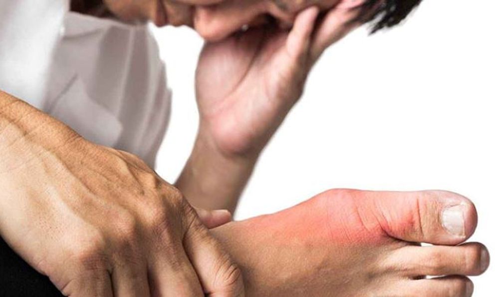 22 tuổi đã mắc gút, gan nhiễm mỡ, rối loạn mỡ máu: Nguyên nhân là ăn 1 thứ quá nhiều, làm 1 việc quá ít