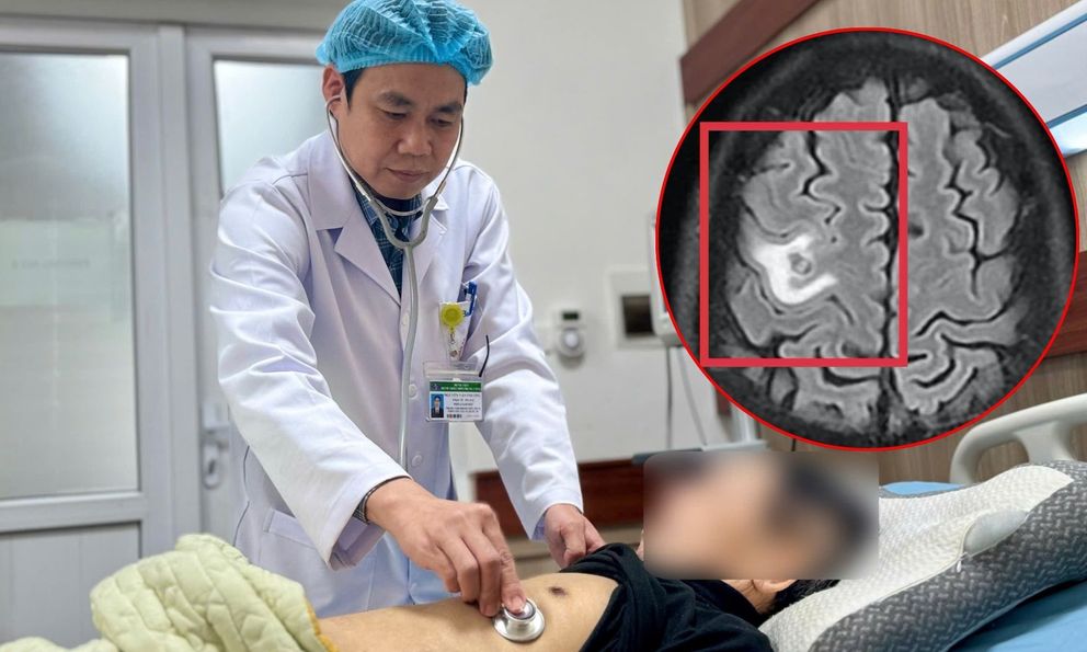 Người đàn ông Hà Nội tổn thương não diện rộng do nguyên nhân bất ngờ - không phải khối u