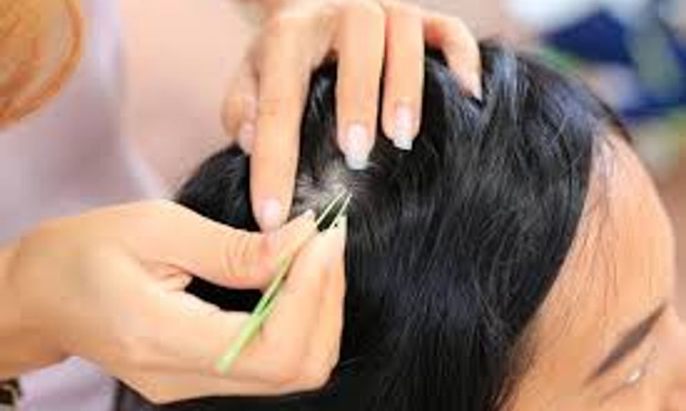 Hóa ra đây là lý do bạn không nên nhổ tóc bạc
