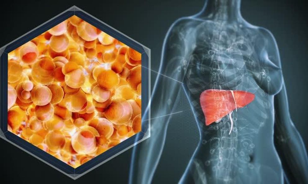 1 bệnh về gan “bùng lên”, người trẻ cũng không còn an toàn: Bác sĩ chỉ ra xu hướng điều trị mới