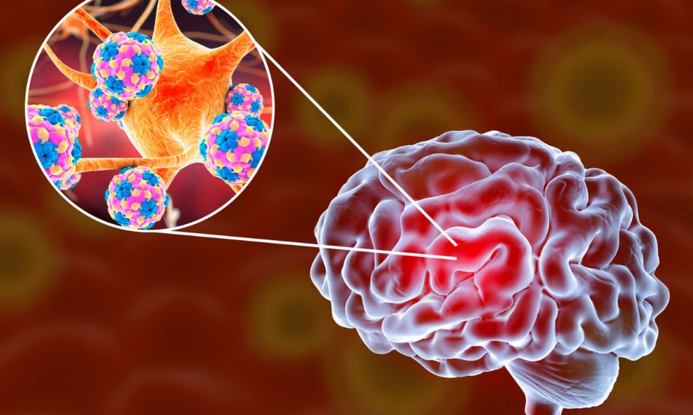 Người phụ nữ viêm màng não nguy kịch tính mạng: Bác sĩ nói thẳng thủ phạm đến từ môi trường sống